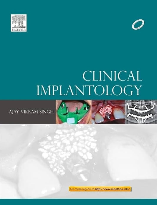 Clinical Implantology, 1e 1st Edition